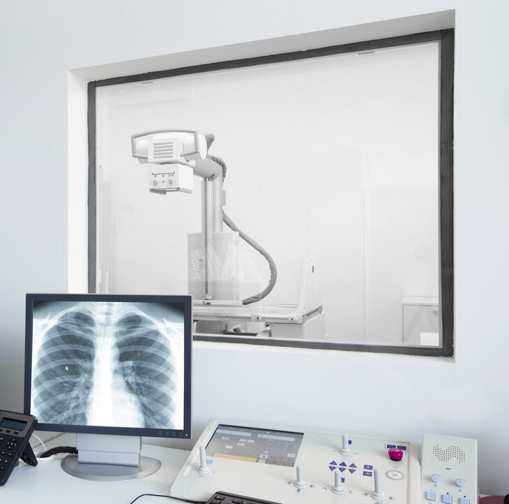 Radiografia coloanei vertebrale - principala metodă de diagnosticare a osteocondrozei