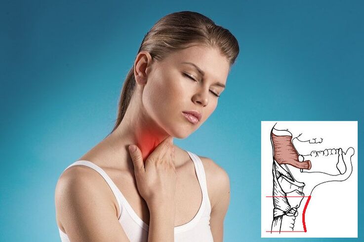 Dureri în gât cu osteocondroză cervicală din cauza compresiei nervoase