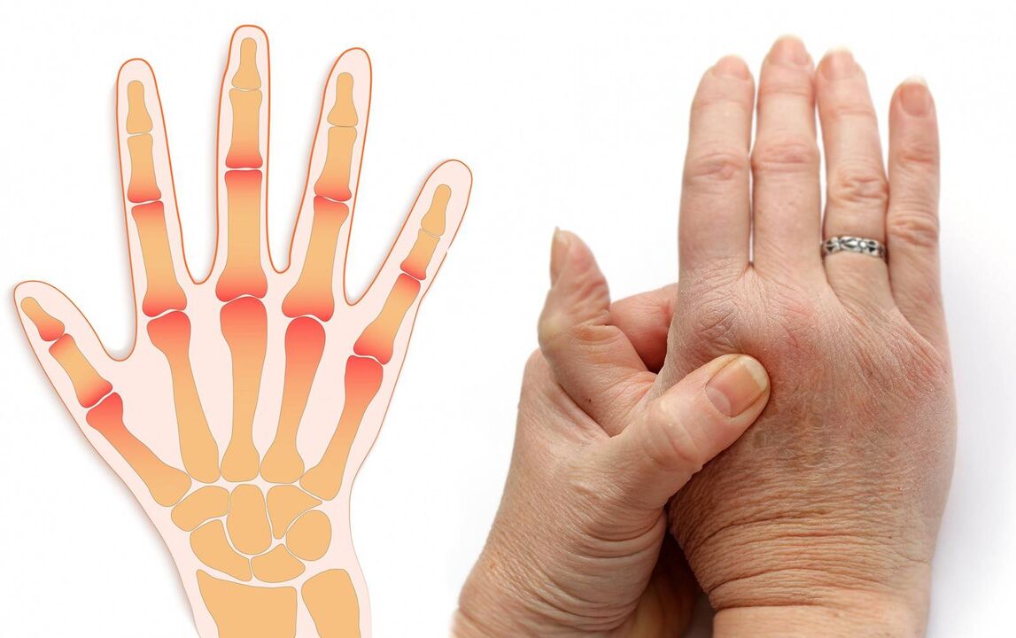 boli ale degetelor