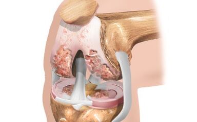 Schema ligamentelor