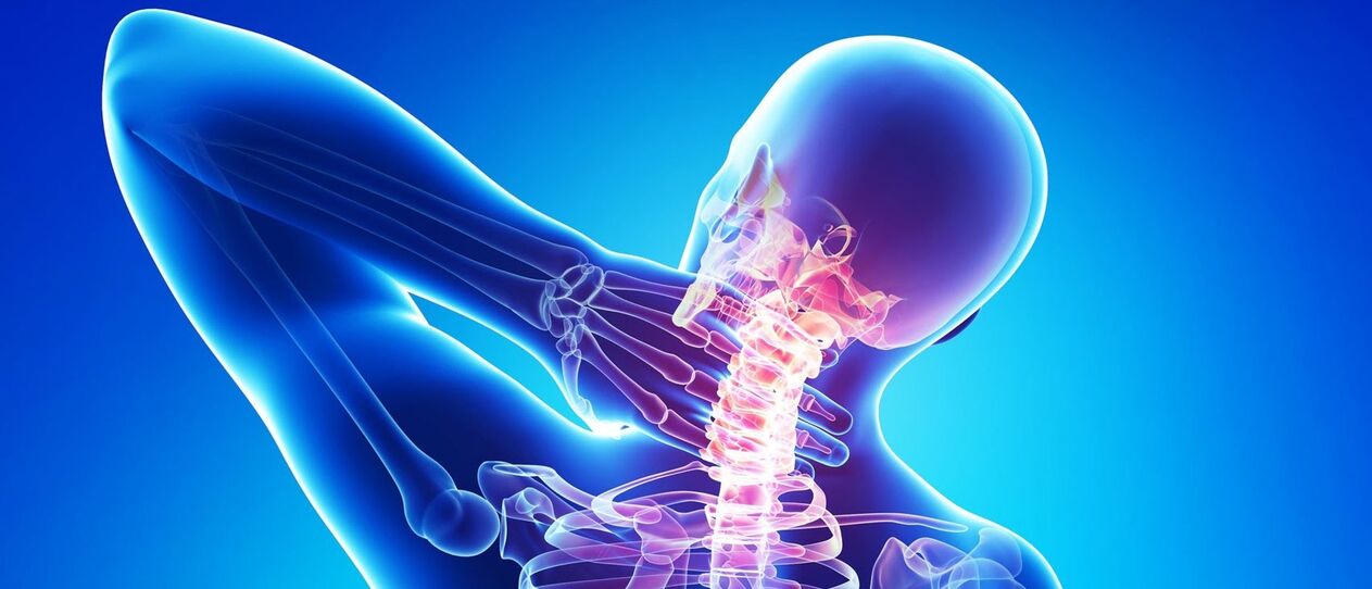 Osteochondroza cervicală este un proces patologic în zona coloanei vertebrale