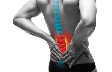 Osteocondroza este o boală a coloanei vertebrale